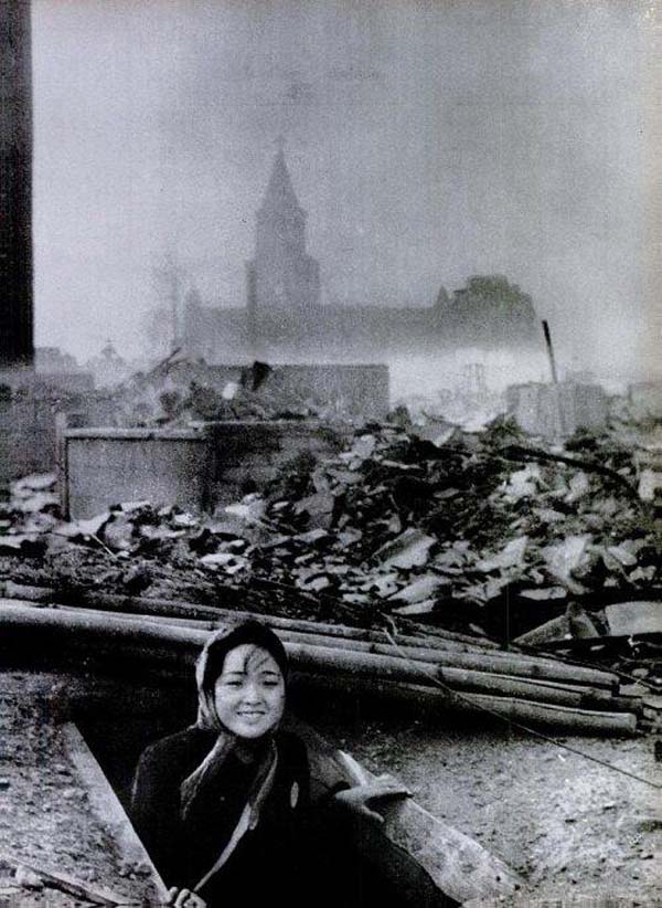 9.-A-woman-that-survived-the-Nagasaki-bombing-1945